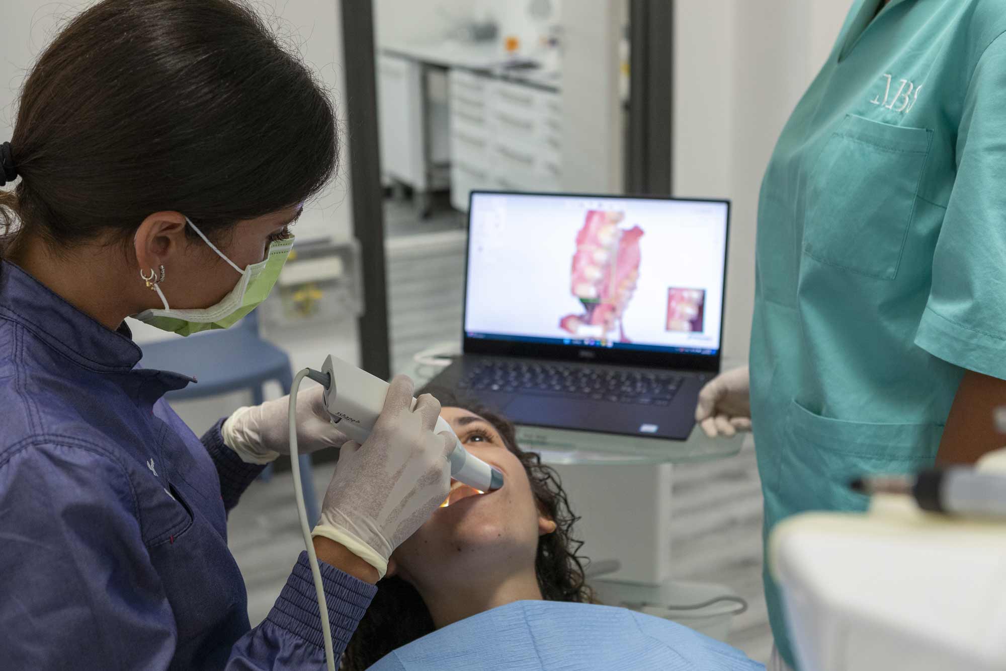 scansione arcata dentale 3d