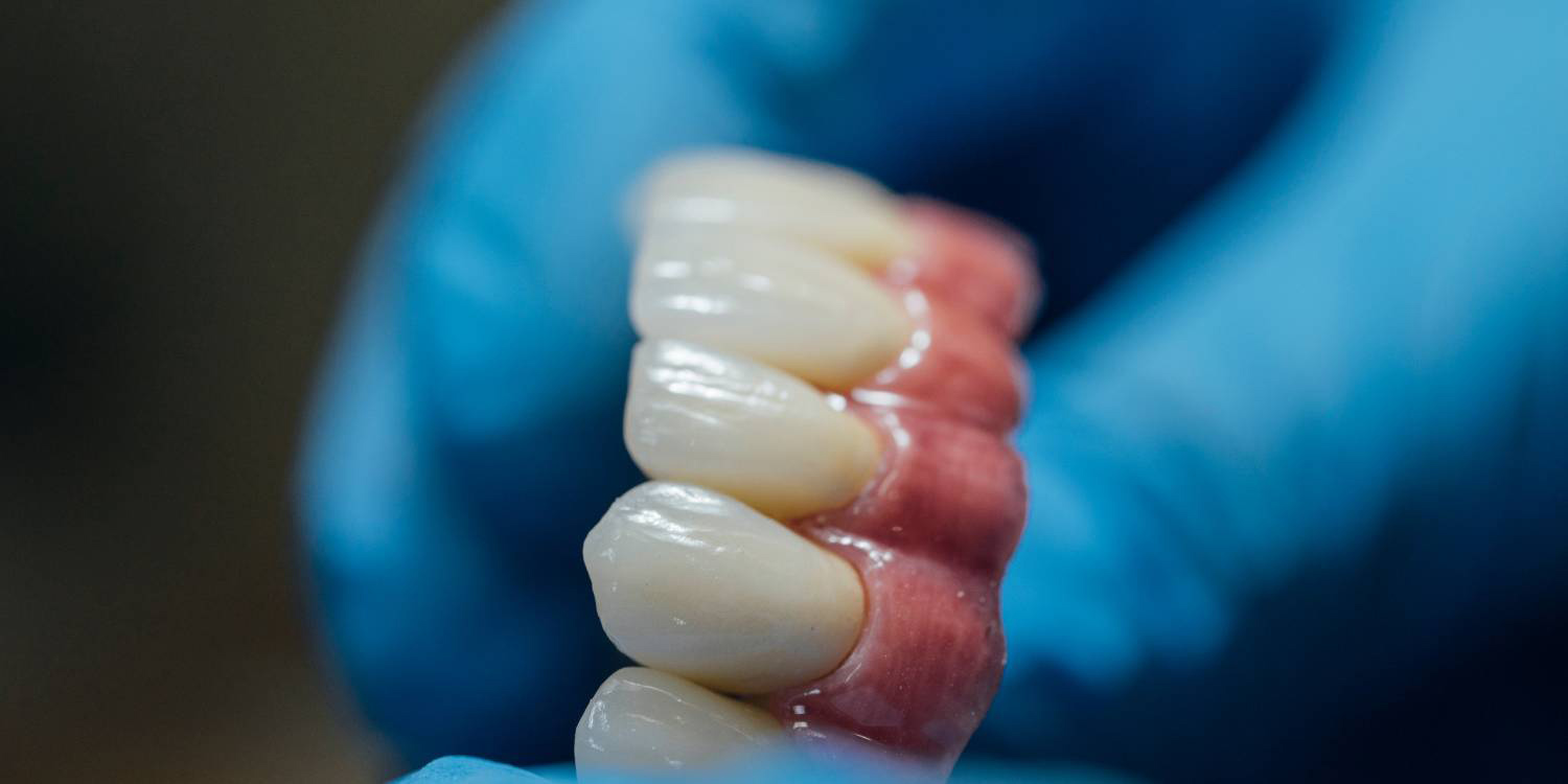 protesi_dentaria mobile