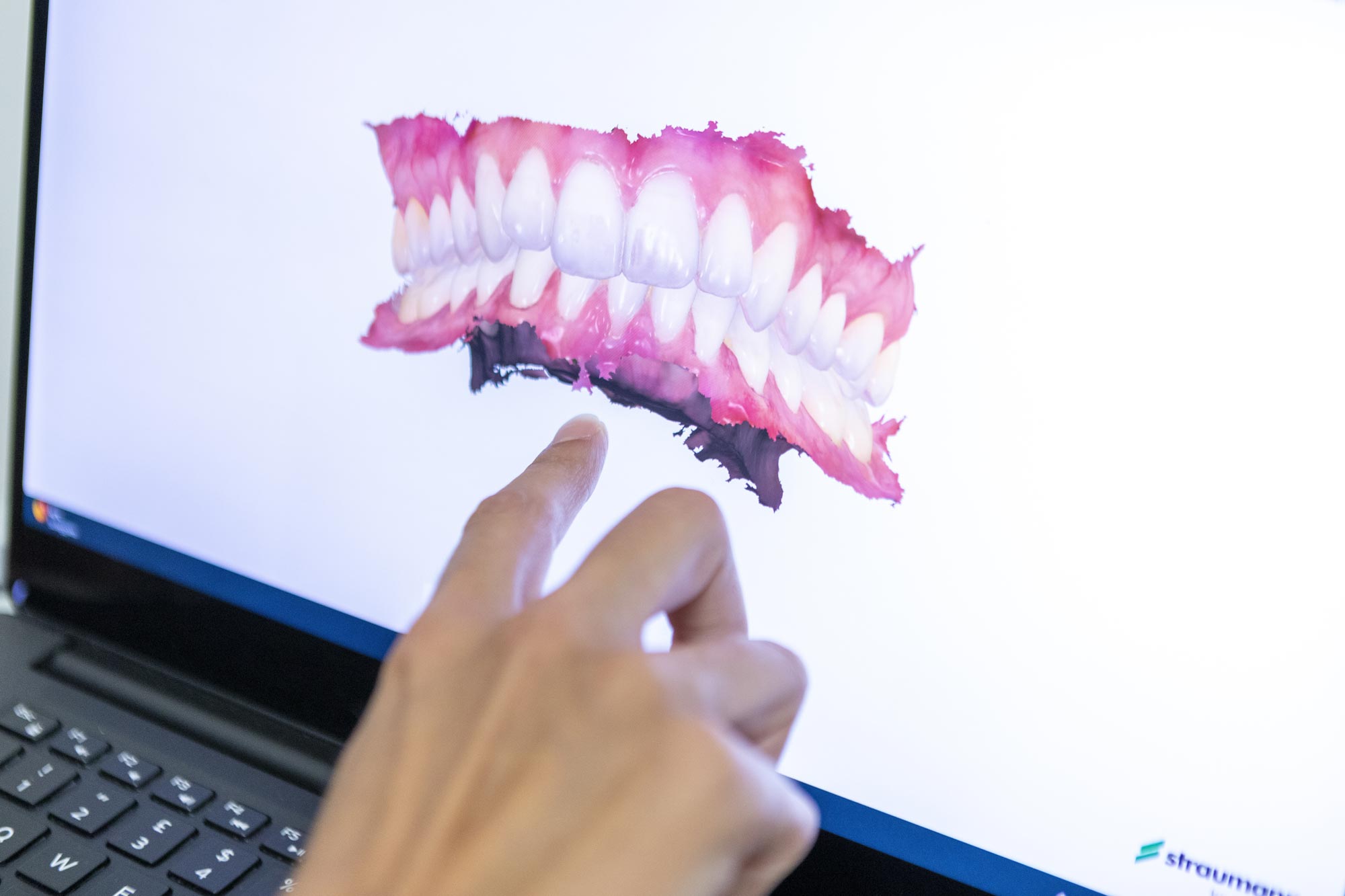macchinario per radiografia dentistica